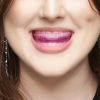 ULTIMATE BEAUTY - LIP ASSIST -  Lippenstraffungspad für PMU